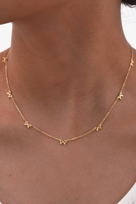 Gold necklace with star-shaped pendants on a person's neck